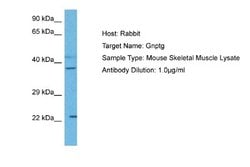 GNPTG Antibody, Novus Biologicals 100 &mu;L | Buy Online | Novus Biologicals | Fisher Scientific